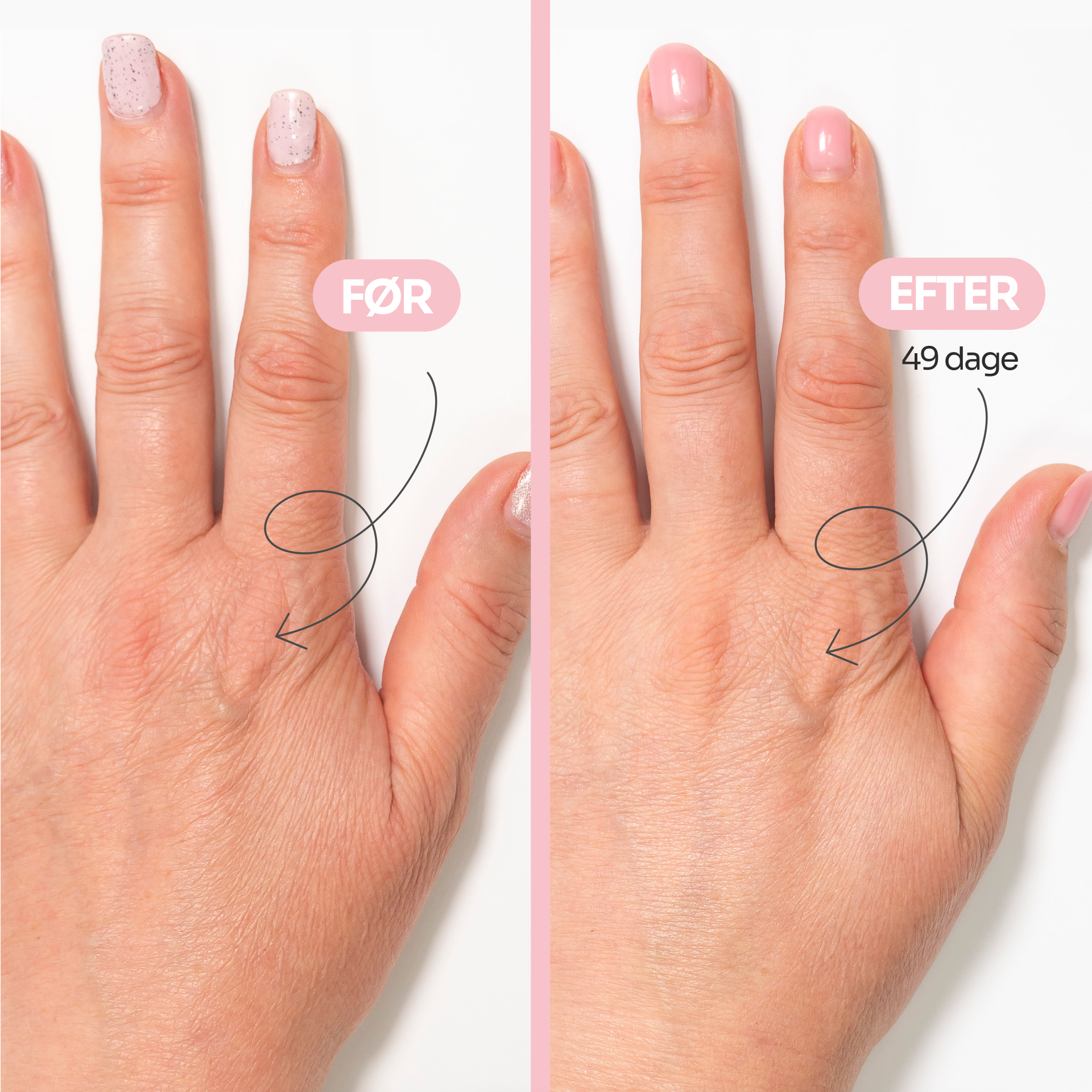 AGE-DEFYING hand cream